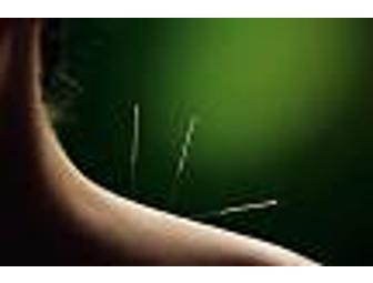 Two acupuncture treatments at A Return to Health