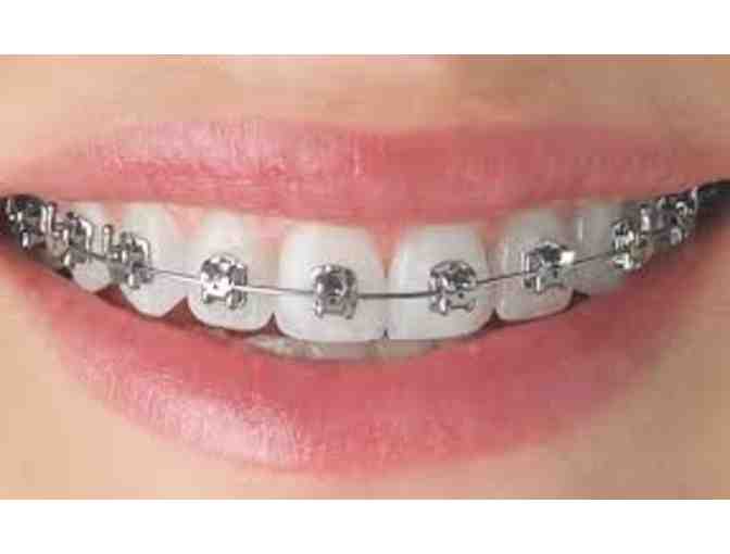 Newhart Orthodontics - PHASE I Orthodontic Treatment - $3620 Gift Certficate