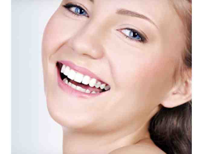 Rembrandt Sapphire Laser Teeth Whitening - Zeidler & Zeidler Dental Group