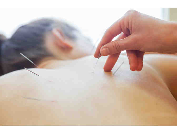 Constellation Acupuncture Gift Certificate
