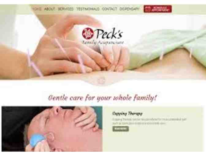 Pecks Family Acupuncture -- Two Complimentary Sessions - Acupuncture and Facial Cupping