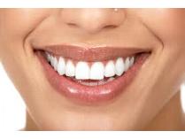 Zoom II Tooth Whitening