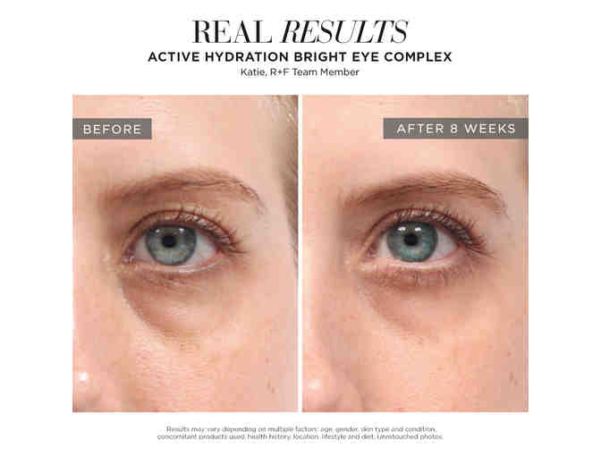 Rodan and Fields Eye Cream and Hydration Bright Eye Complex