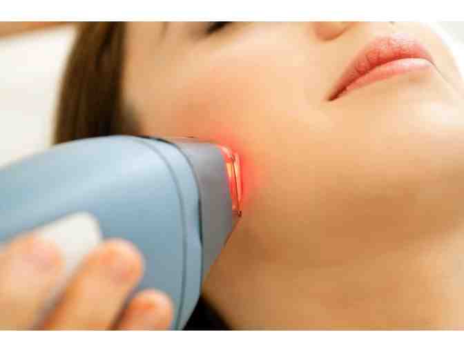 Skin Beauty Treatment: Laser Resurfacing - Photo 1