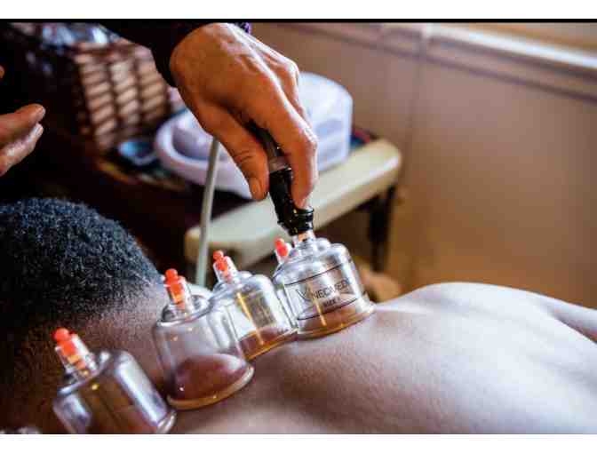 Acupuncture or Shonishin (Pediatric) Treatments at Alma Acupuncture