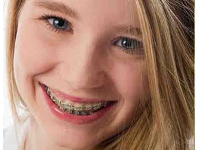 Complete Case of Orthodontic Treatment- Leonard Orthodontics* This is not going to Live!!*