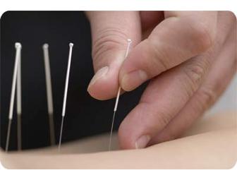 Acupuncture Evaluation, Assessment and 2 Treatments