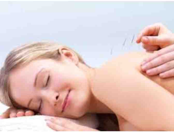 Acupuncture & Herbal Medicine Consultation and Treatment + 1 Follow-Up Visit