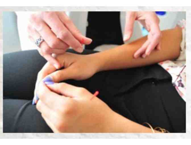 Acupuncture & Herbal Medicine Consultation and Treatment + 1 Follow-Up Visit