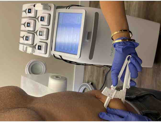 Trusculpt ID body contouring/Fat Elimination