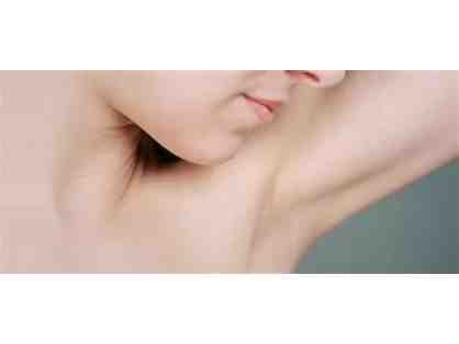 Laser Hair Removal Underarms Package