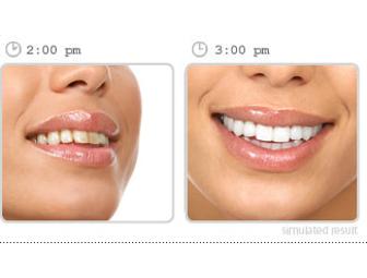 Gift Certificate for $100 0ff Brite Smile- Teeth Whitening