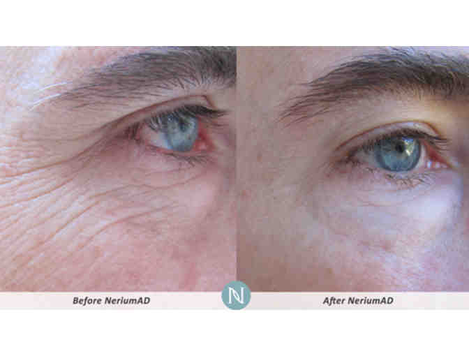 NeriumAD Age-Defying Treatment