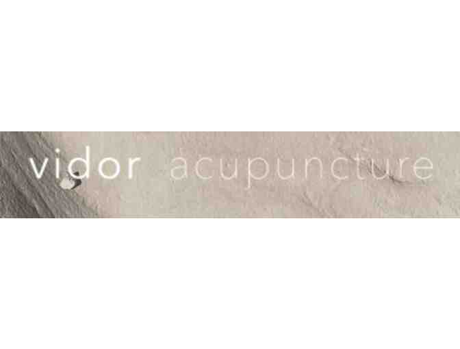 Vidor Acupuncture - 90 min Acupuncture consultation