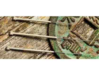 Acupuncture Treatment in your Home or Office with Janna Esina, L.Ac., MSTOM