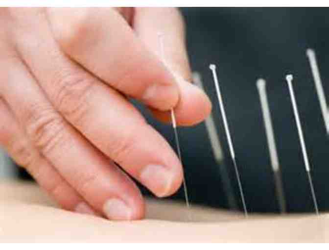 Acupuncture Treatment in your Home or Office with Janna Esina, L.Ac., MSTOM