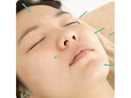 Energy Matters Acupuncture: Acupuncture Facial Rejuvenation Deluxe