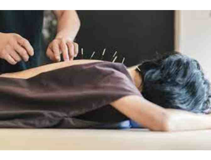Candise Yang Acupuncture: $275 gift certificate