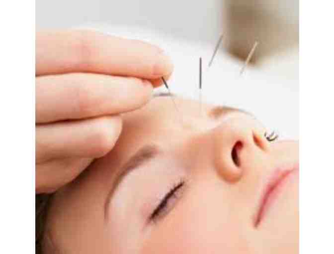 ! Initial Acupuncture Visit at NEW YORK ACUPUNCTURE