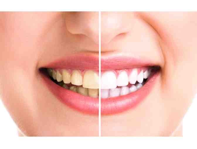 Dr. JOEL KLASFELD - Professional Tooth Whitening