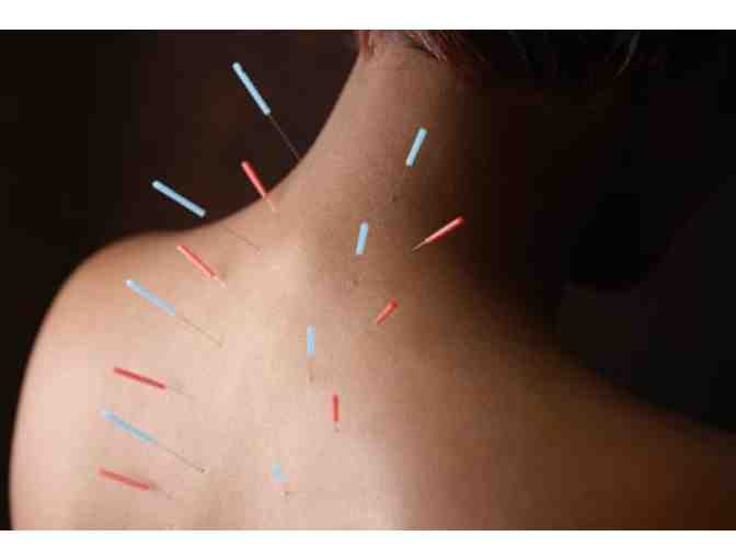 Acupuncture with Michaela Martin ND, LAC