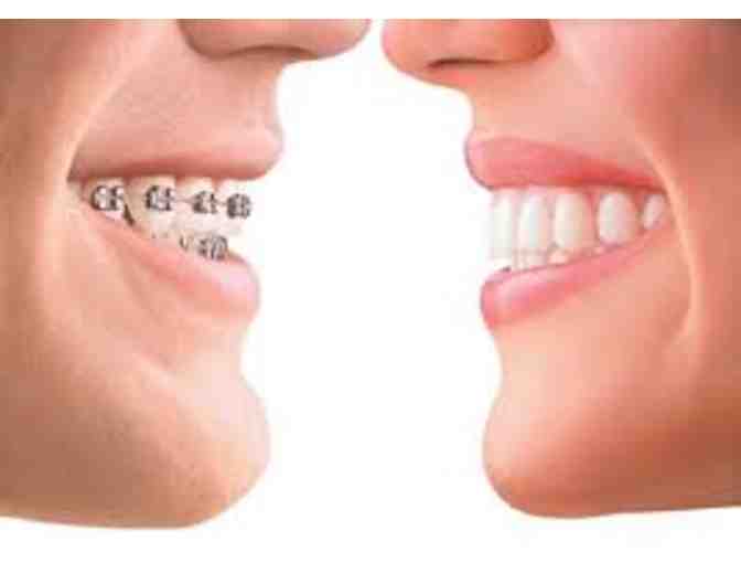 Newhart Orthodontics - Phase 1 Orthodontics Treatment