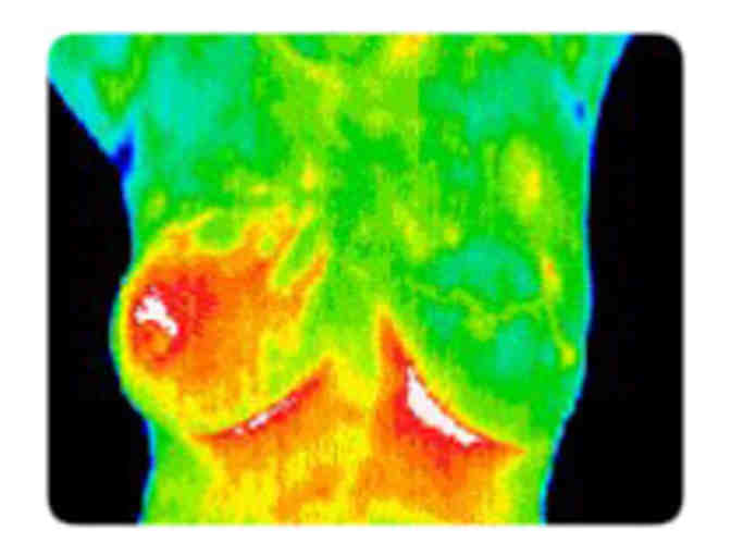 Inner Image Breast Scan Using Clinical Thermography