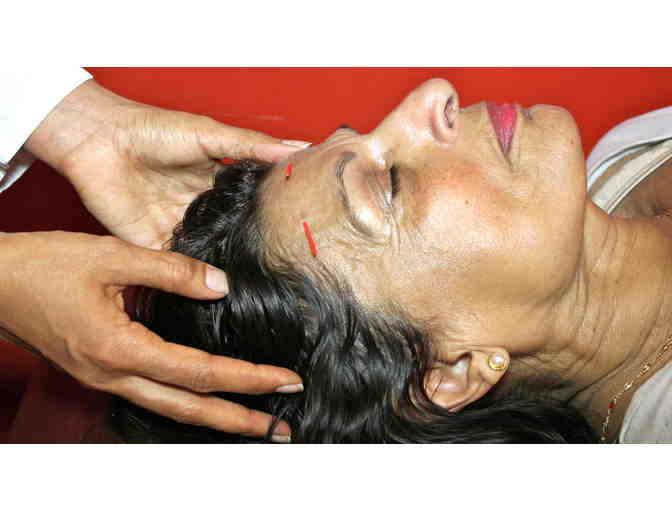 Dharma Health Institute - Facial Acupuncture Treatment & Oxygen ($250 Value)