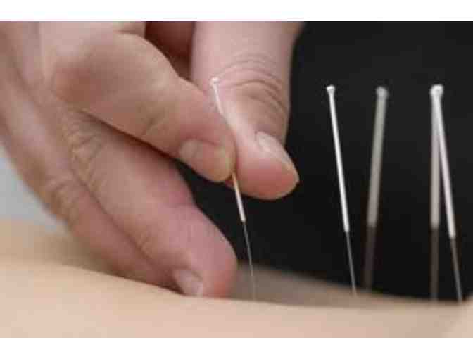 Initial Consultation and Acupuncture Treatment - Live Well Acupuncture San Mateo