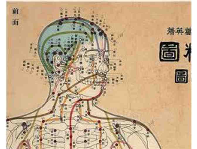 Acupuncture Treatment