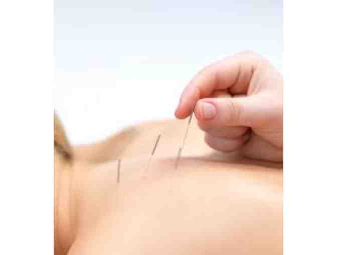 3 Acupuncture Sessions at Pathways to Wellness