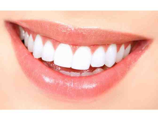 Cosmetic Teeth Whitening  by Moab Dental Health Center